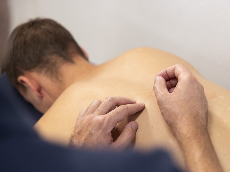 Ein Mann erhält eine Behandlung mit Akupunktur